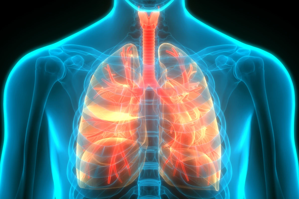 Scientists have developed a new nanoparticle that can carry gene-editing technology directly into the lungs