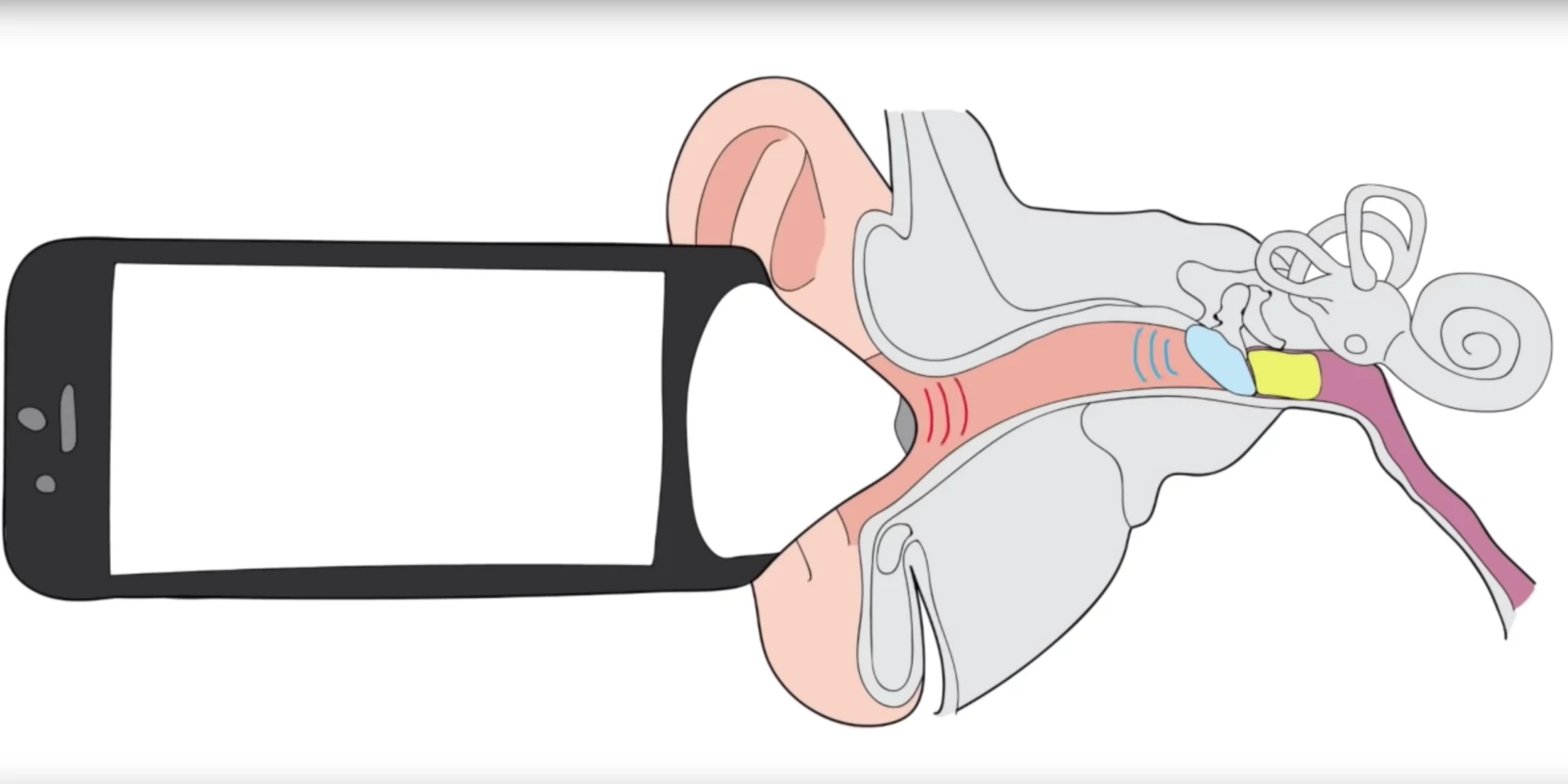 All that's needed is a smartphone, the app and a paper cone to reliably diagnose fluid in the ear
