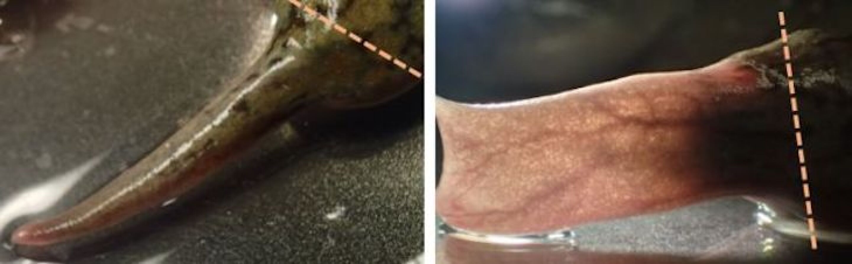 Wearable bioreactor stimulates limb regrowth in frogs