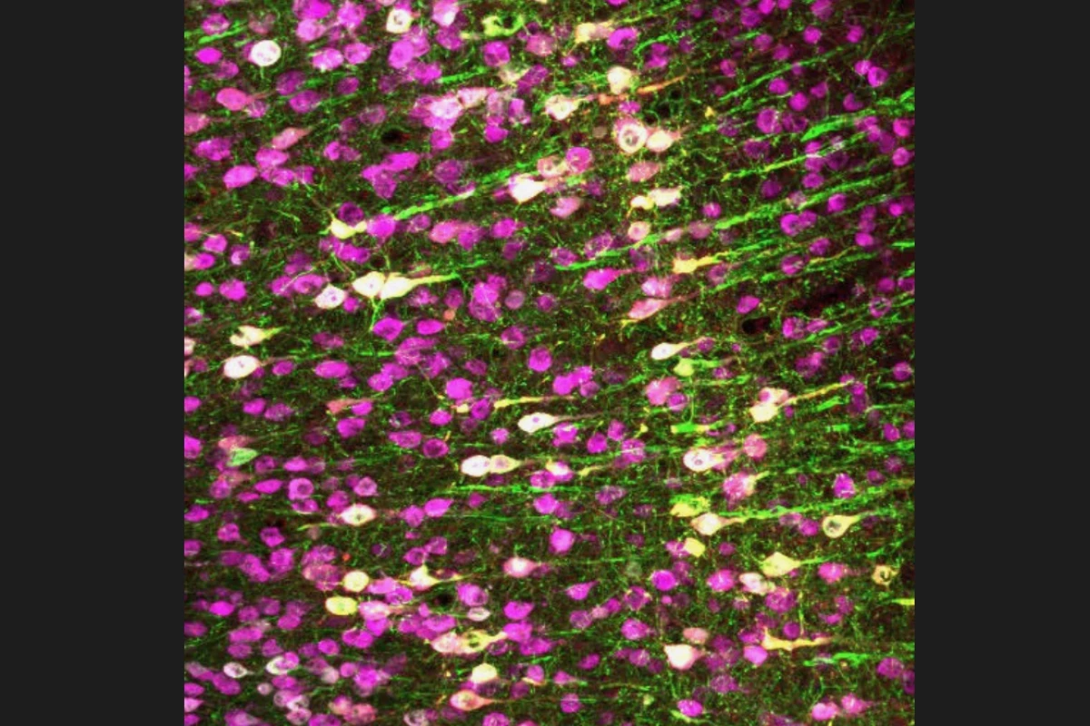 A microscope image of a mouse brain shows regular neurons (magenta) and those that were genetically manipulated to