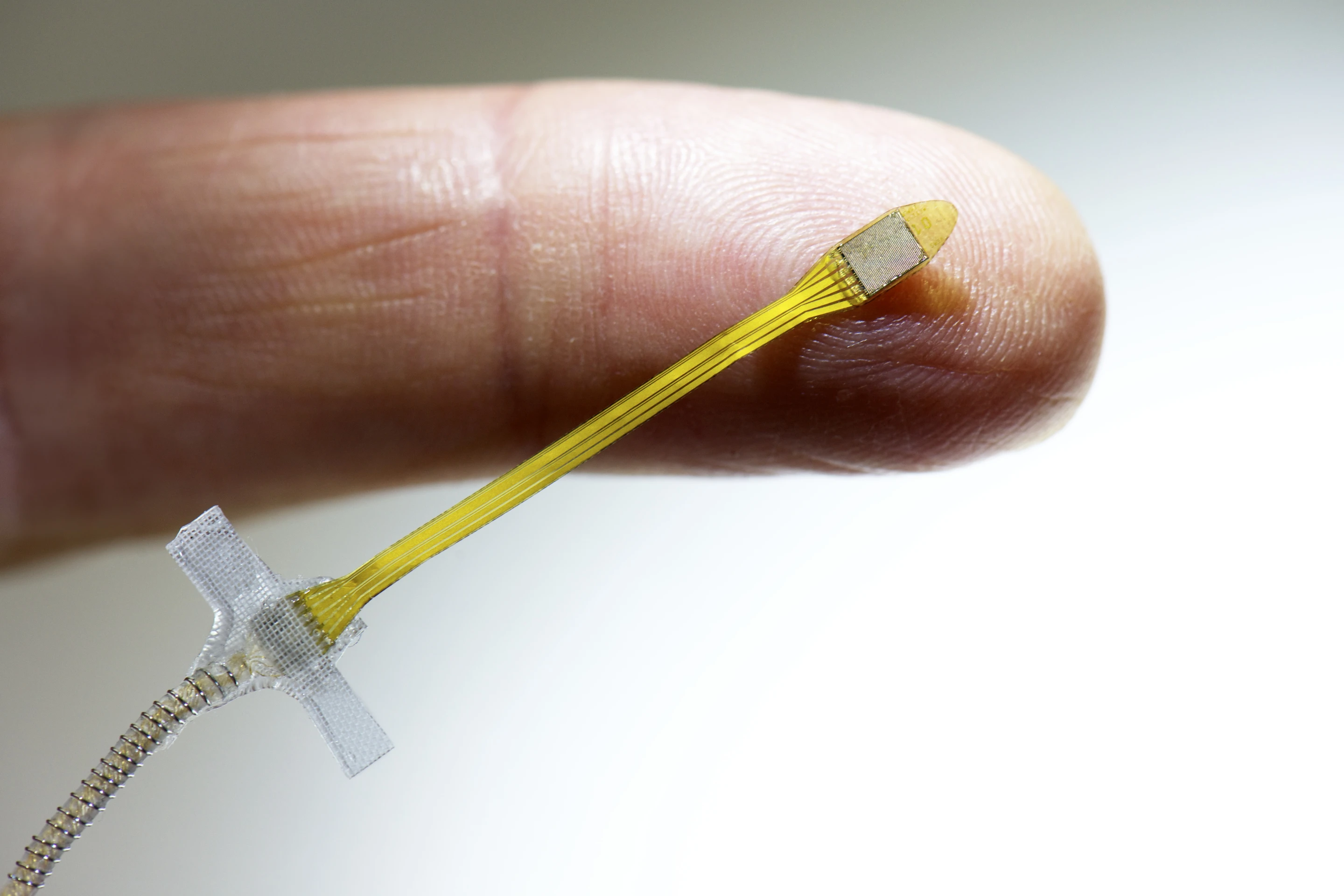 Retinal implant with power cable (Image: Retinal Implant AG)