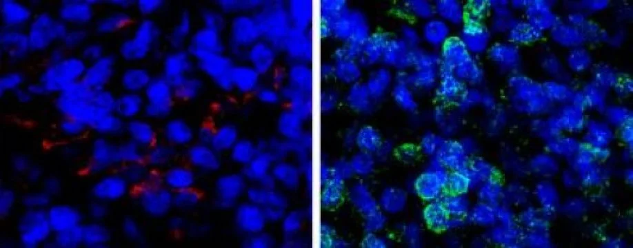 Human mini-brains before and after a dose of the psychedelic 5-MeO-DMT, with affected proteins fluorescing