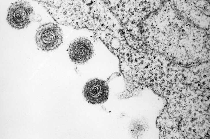 An infected cell releases roseolovirus particles