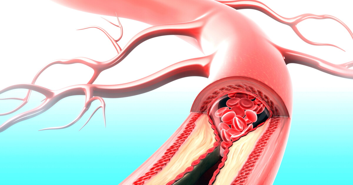 Designer drug targets both heart disease and diabetes