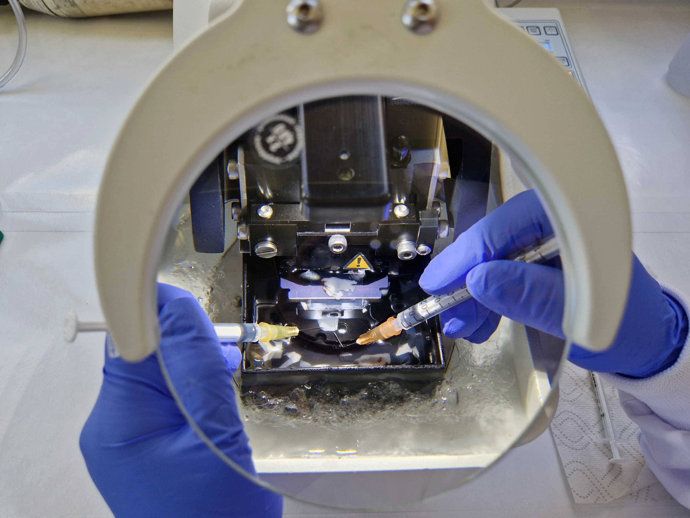 As part of the study, human brain tissue is sectioned into very thin slices using a machine known as a vibratome