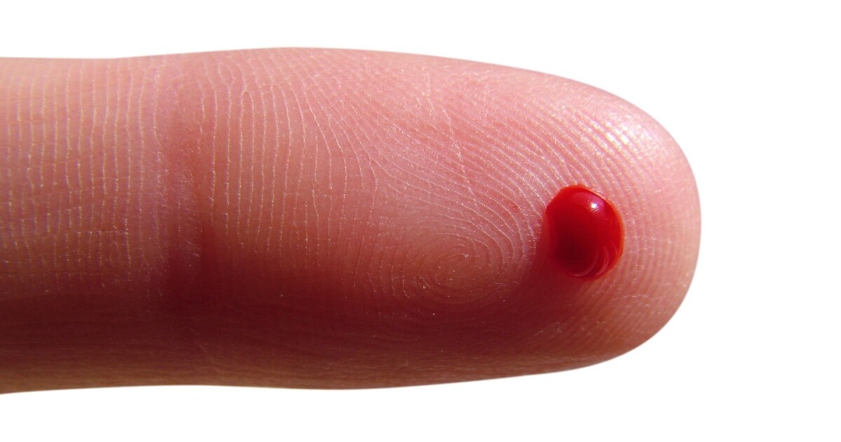 Compact Device Analyzes Blood To Detect Brain Injuries