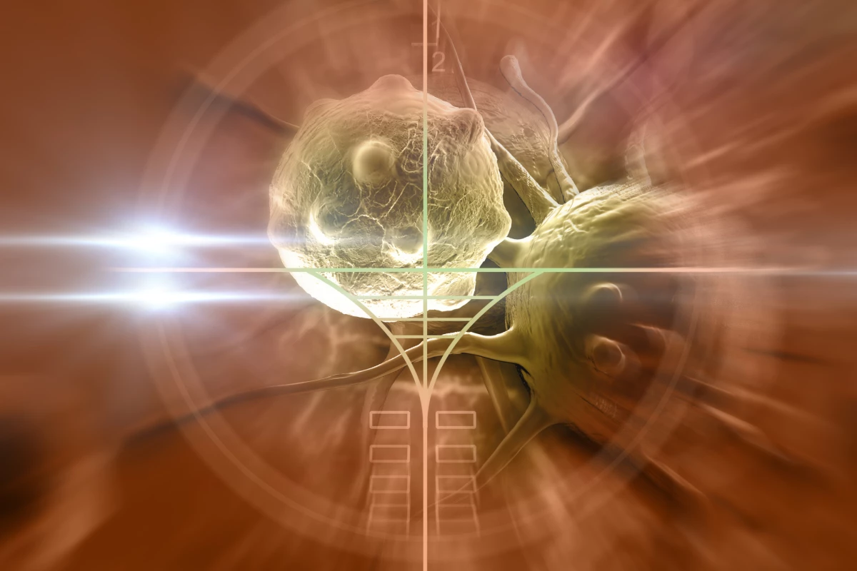 A new understanding of the way lactic acid impedes the body's defenses against tumors raises the prospect of new treatments