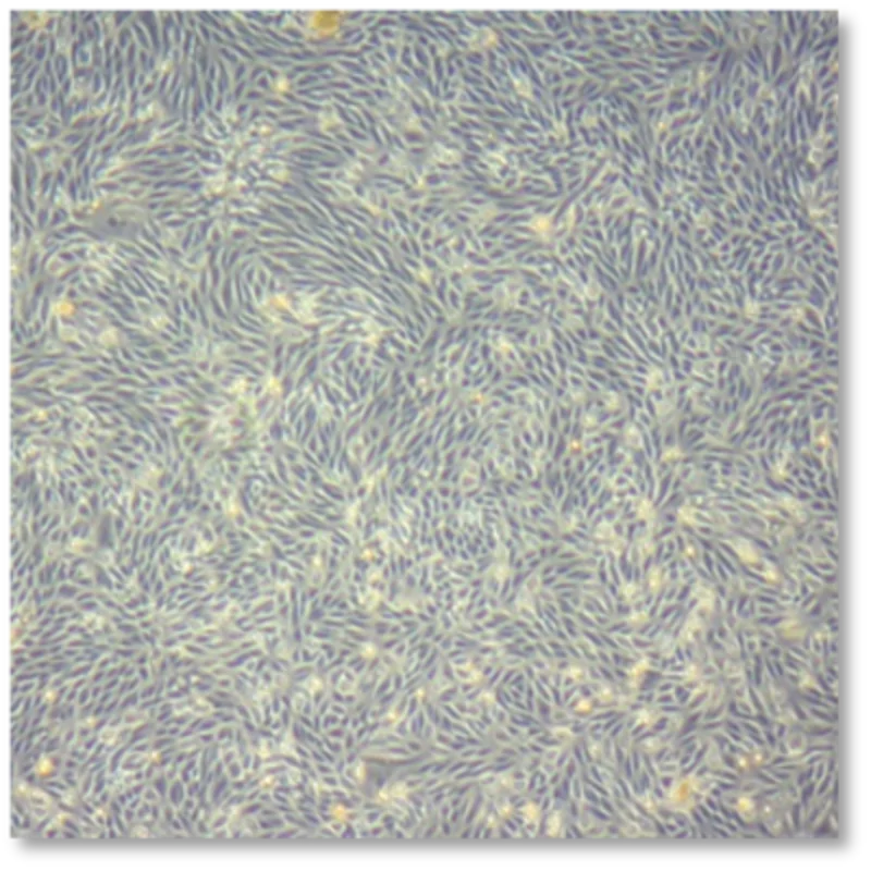 Kidney stem cells, specifically urine-derived renal progenitor cells (UdRPCs)