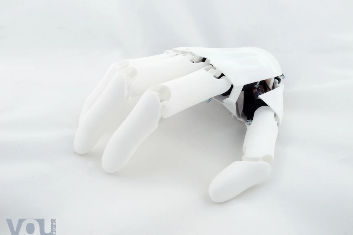 Youbionic says its hands will cost around €1,000, a fraction of the price of current commercial products