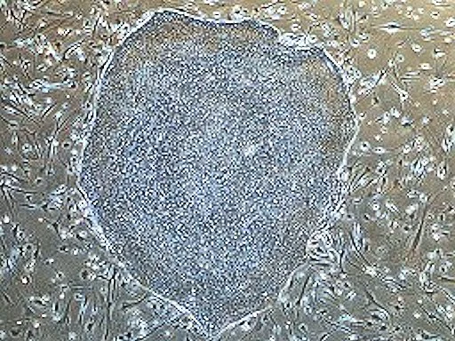A colony of induced pluripotent stem cells regressed from red blood cell lineage-committed stem cells