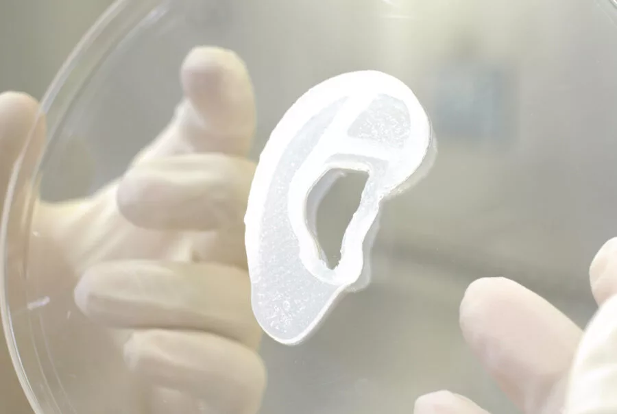 A 3D-bioprinted ear, grown from a patient's own cartilage cells