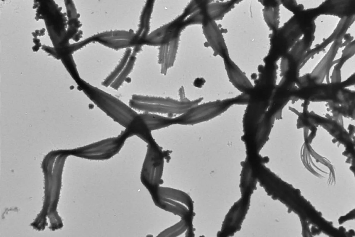 Mariprofundus ferrooxydans PV-1 bacteria (Image: Clara S. Chan)