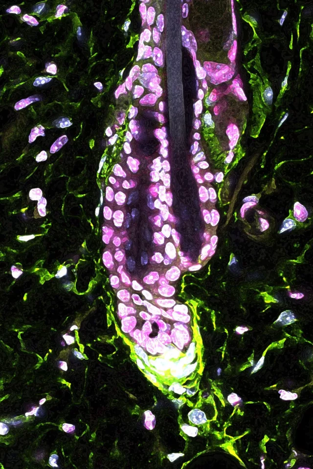 Image shows a mouse hair follicle where dermal papilla cells (green) can be seen producing the Gas6 molecule, which activates hair follicle stem cells