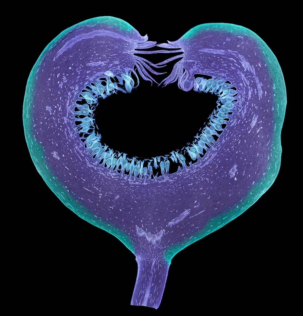Commended, Ficus. Portstewart, Northern Ireland, United Kingdom. "Thin longitudinal section of the developing fruit of a Ficus (fig) plant. Image coloured in Photoshop and displayed in reverse contrast."