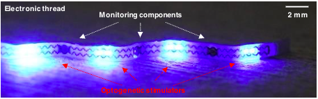 A serpentine-shaped polymer wrap is embedded with sensors and designed to fit snugly around the bladder