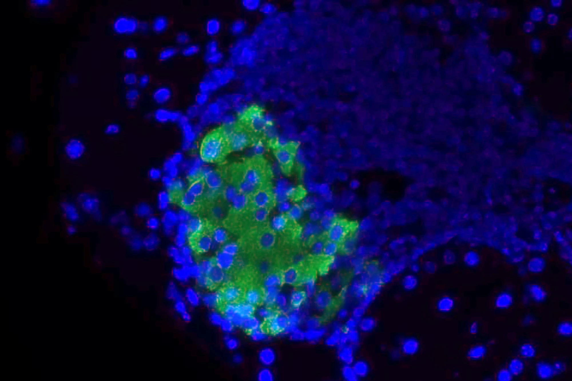 A cluster of insulin-producing beta cells (green) under attack by a dense cluster of immune cells (blue dots) in a preclinical model of type 1 diabetes