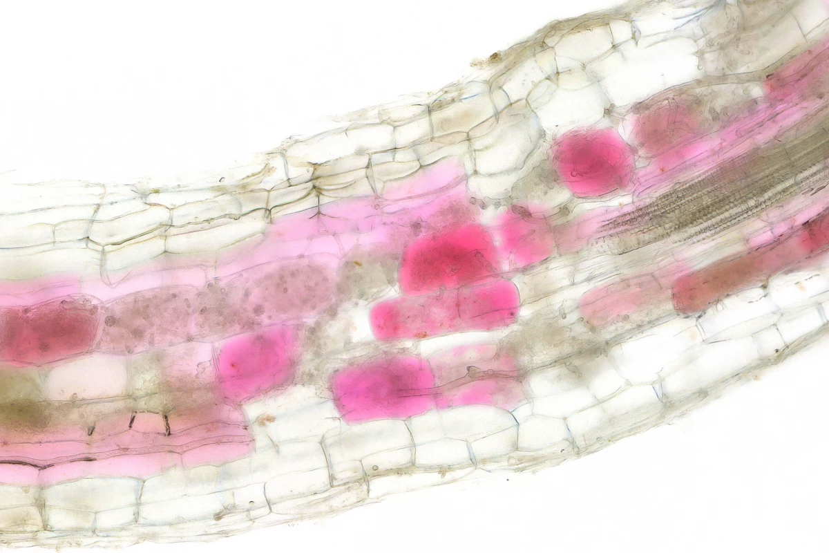 Root cells turn red when colonized by beneficial arbuscular mycorrhiza fungi