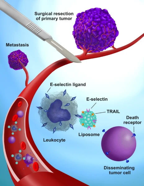A diagram explaining how the Vanderbilt team's TRAIL-coated leukocytes work to kill rogue cancer cells