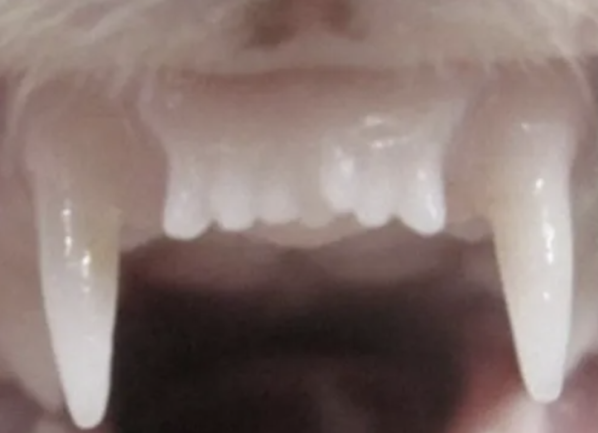 In the ferret study, the drug led to the growth of a new tooth (fourth from the left) and also strengthened the bones in the existing teeth.