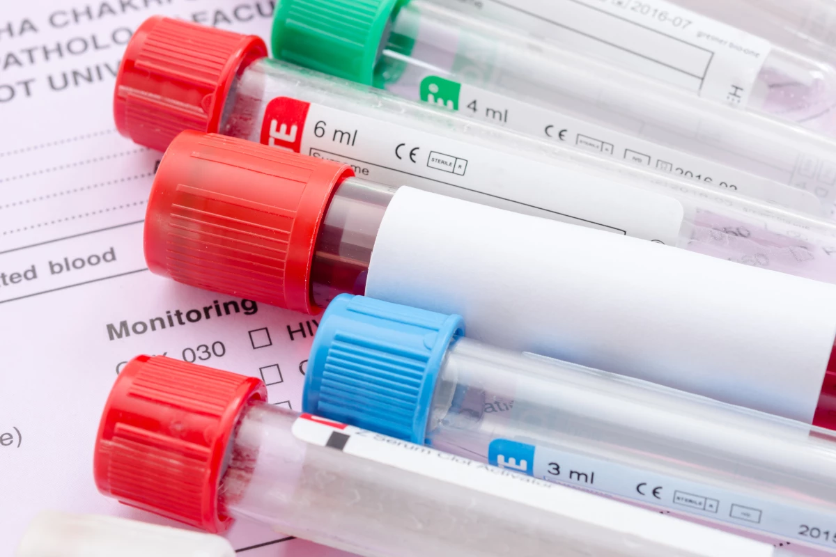 A new blood test looks for patterns of metabolites that correlate with obesity