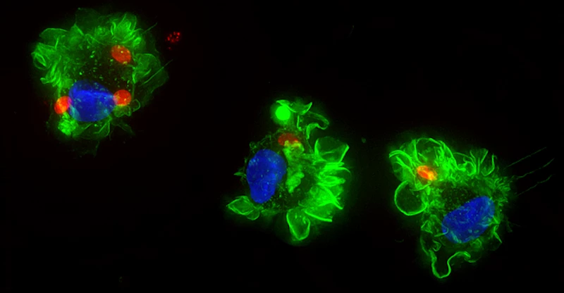 Immune cells infected with the toxoplasma parasite (red)