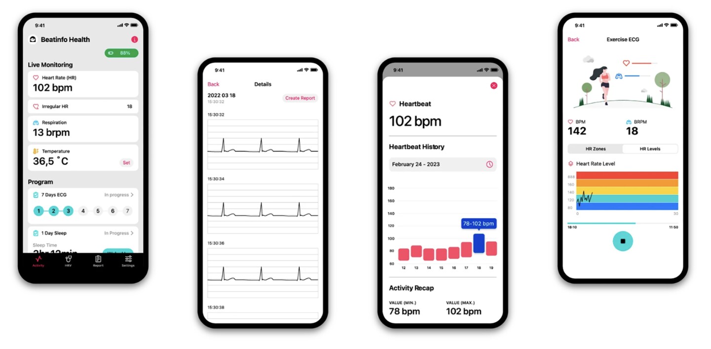 Singular Wings' Health app receives data in real-time from the CGM