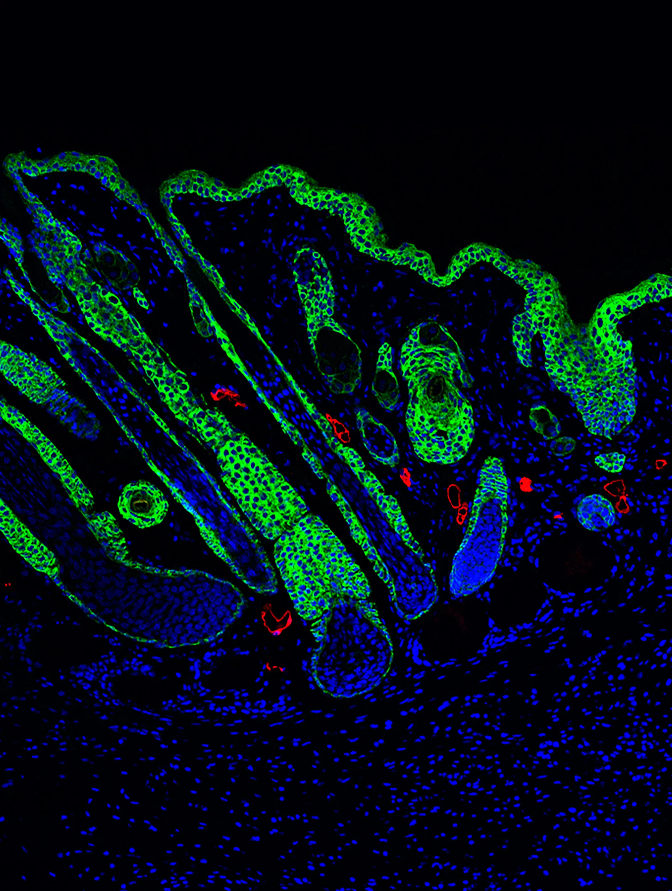 A section of skin – complete with hair follicles – regenerated by the new hydrogel