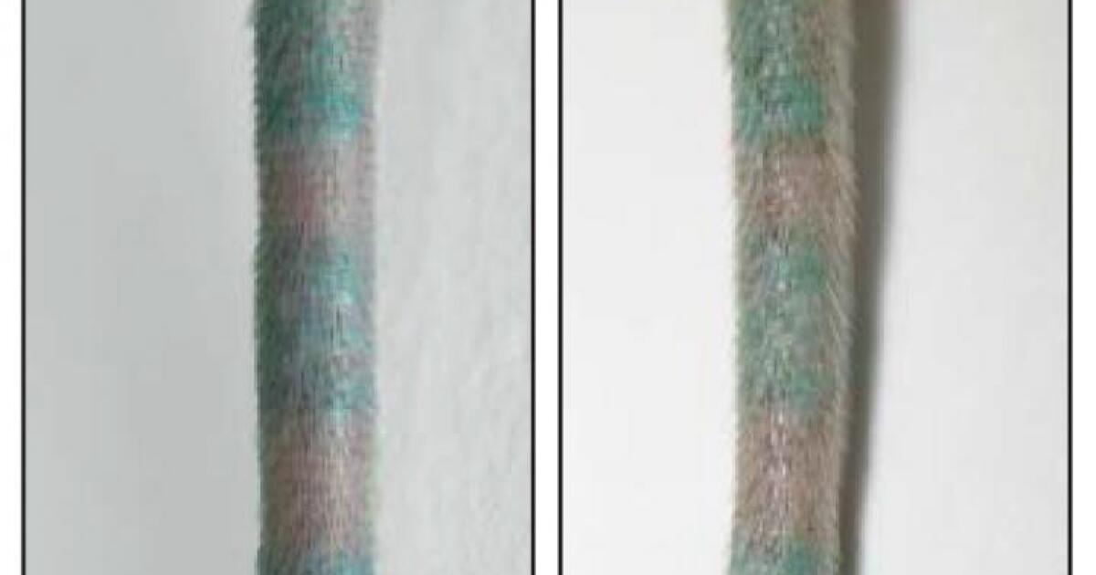 How the immune system keeps tattoos permanent despite constant skin