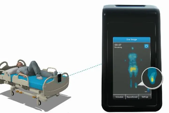 The MAP System provides a real-time display of the pressure points on a patient's body