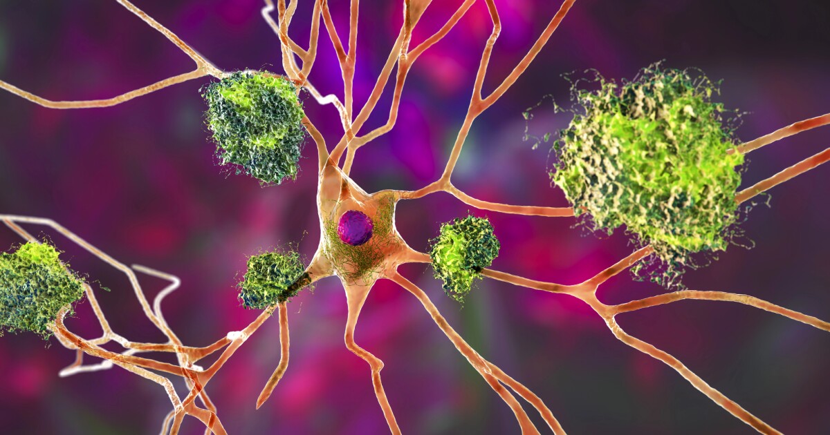 Alzheimer’s protein may boost aging immune system Alzheimer’s protein may boost aging immune system