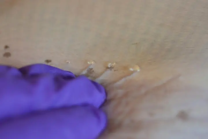 The "jelly" seen on the skin of a skate