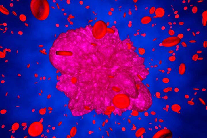 The new treatment is currently under application for review by the FDA