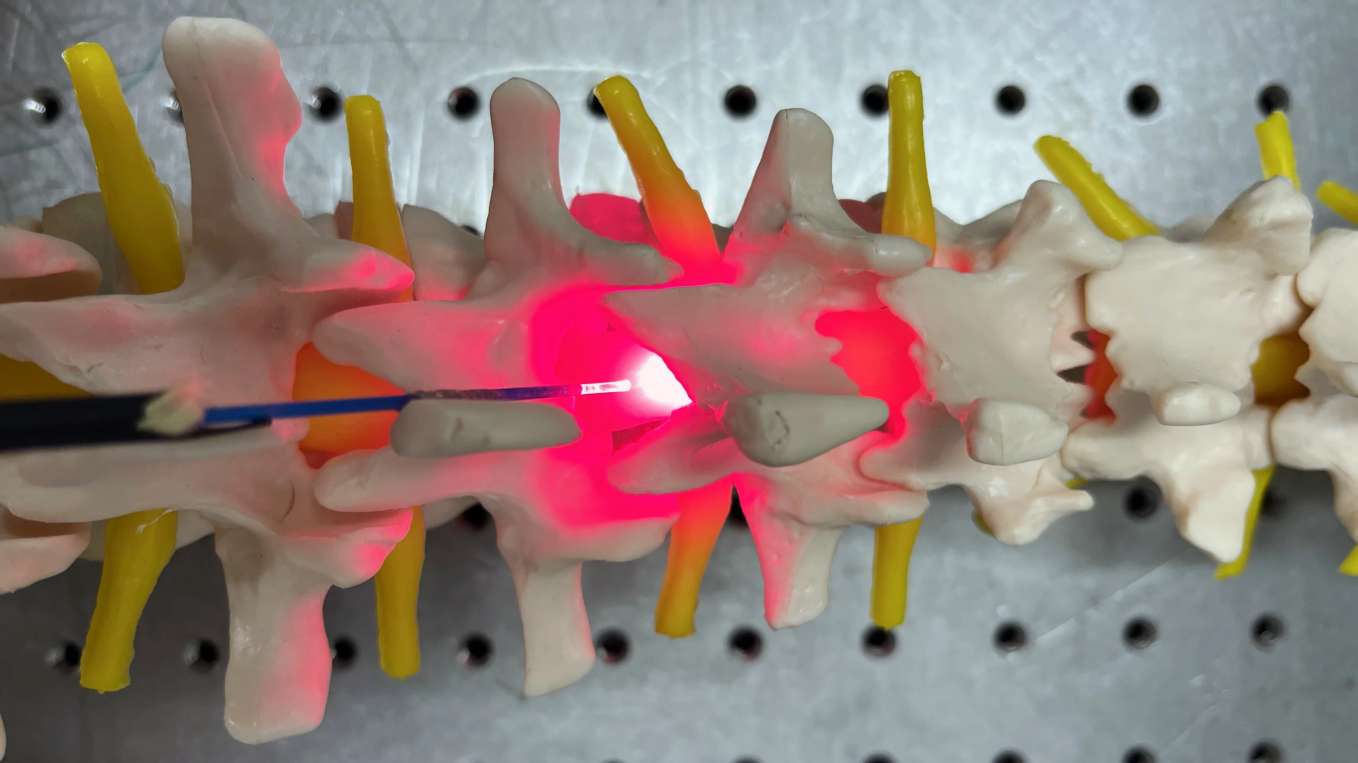 Direct red-light therapy improved spinal injuries