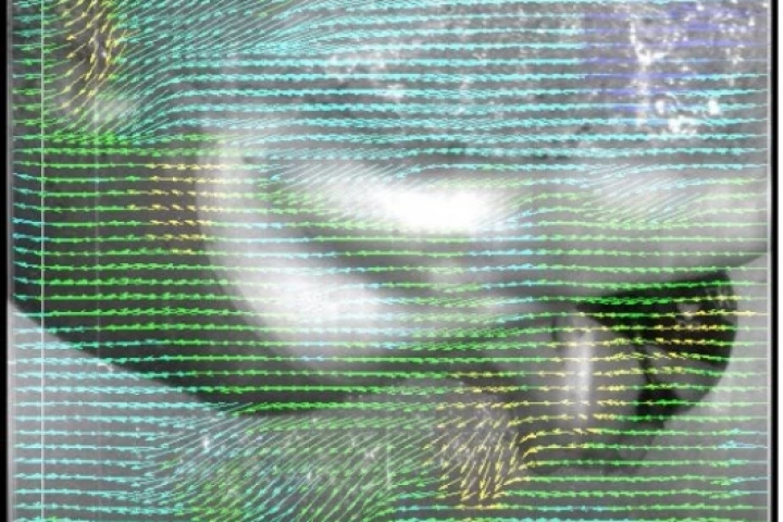 Digital Particle Image Velocimetry video-based flow measurement technique