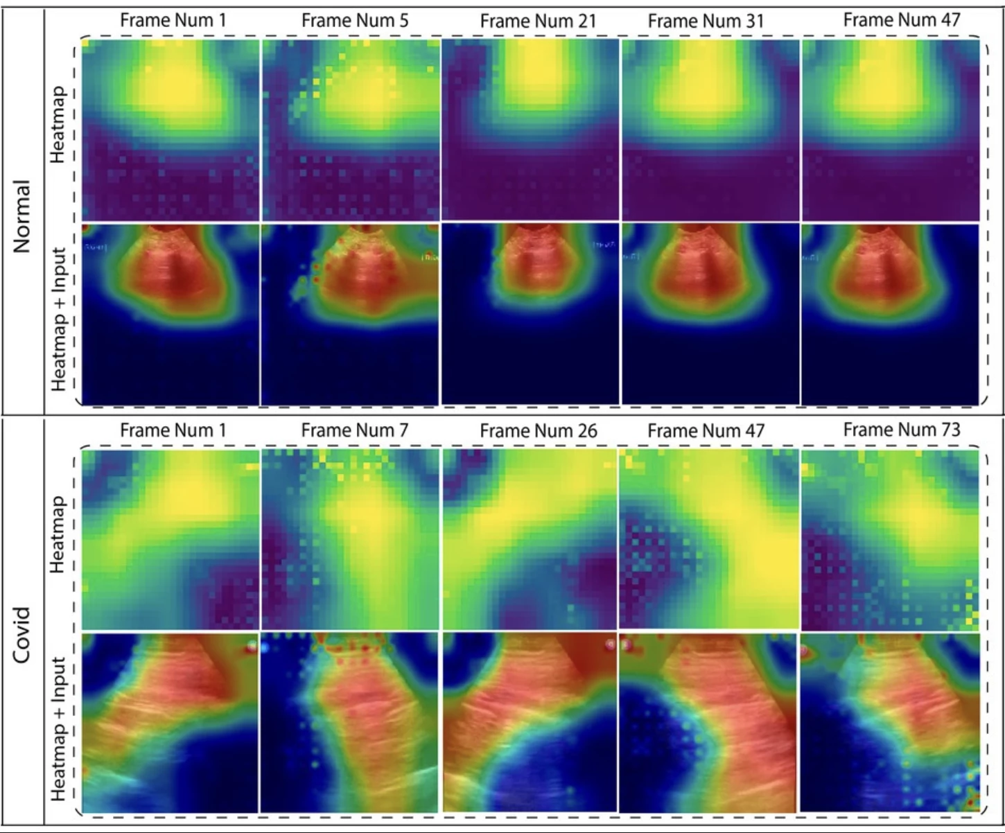 While they look different, on frames of ultrasounds they can be harder for the naked eye to distinguish