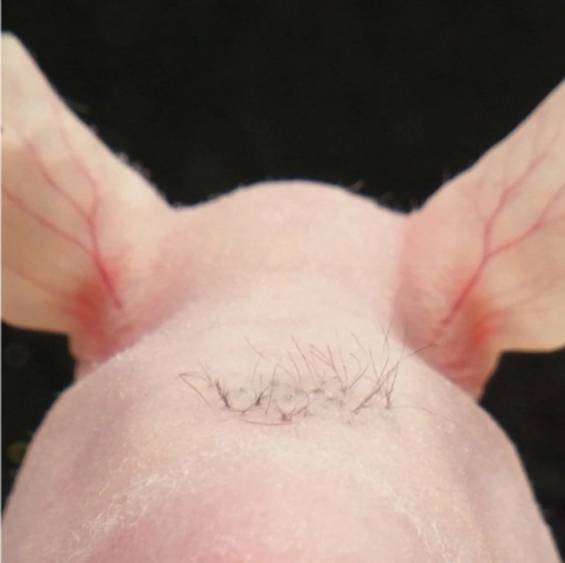 Intracutaneus transpantation of the bioengineered follicle germ at high density