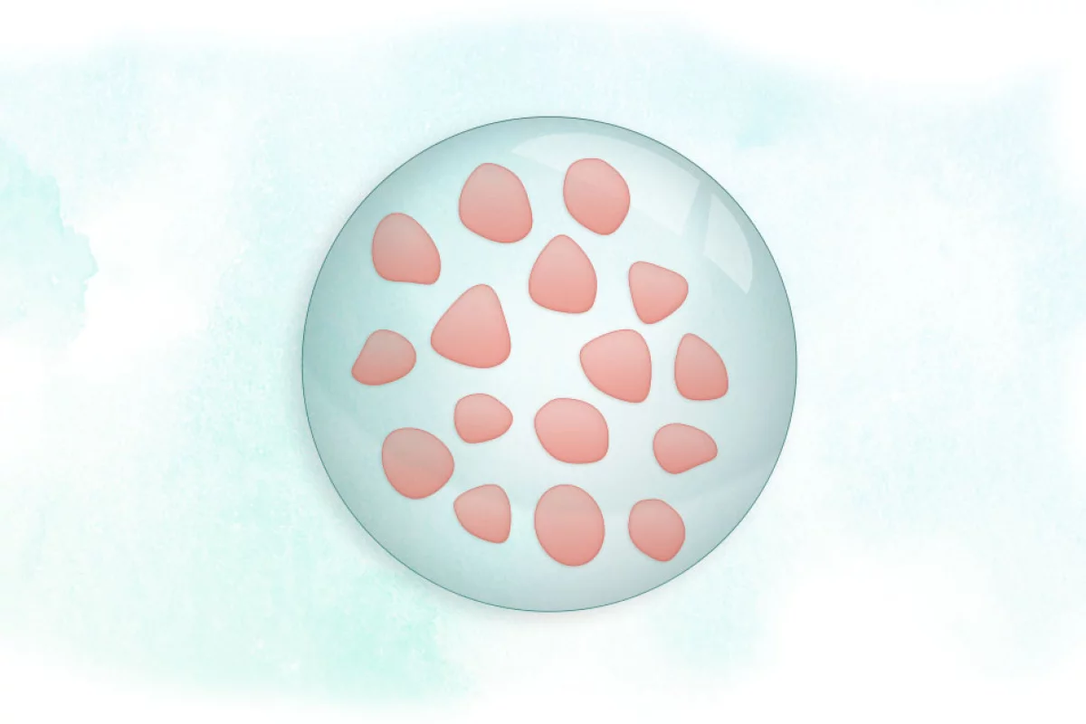 A simplified diagram of the Nose2Brain patch, loaded with biomaterial-based drug particles