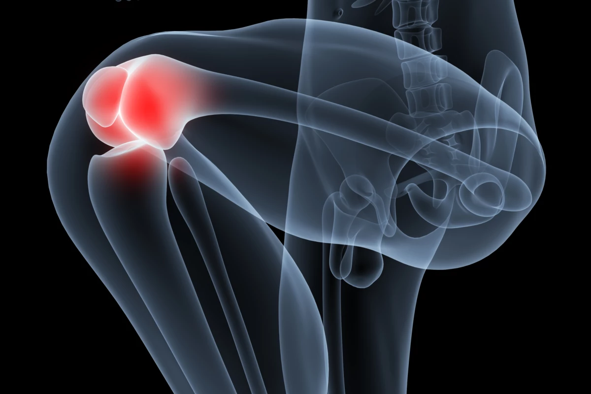 A new understanding of a key protein in the inflammation process has raised the prospect of new drugs for conditions like rheumatoid arthritis