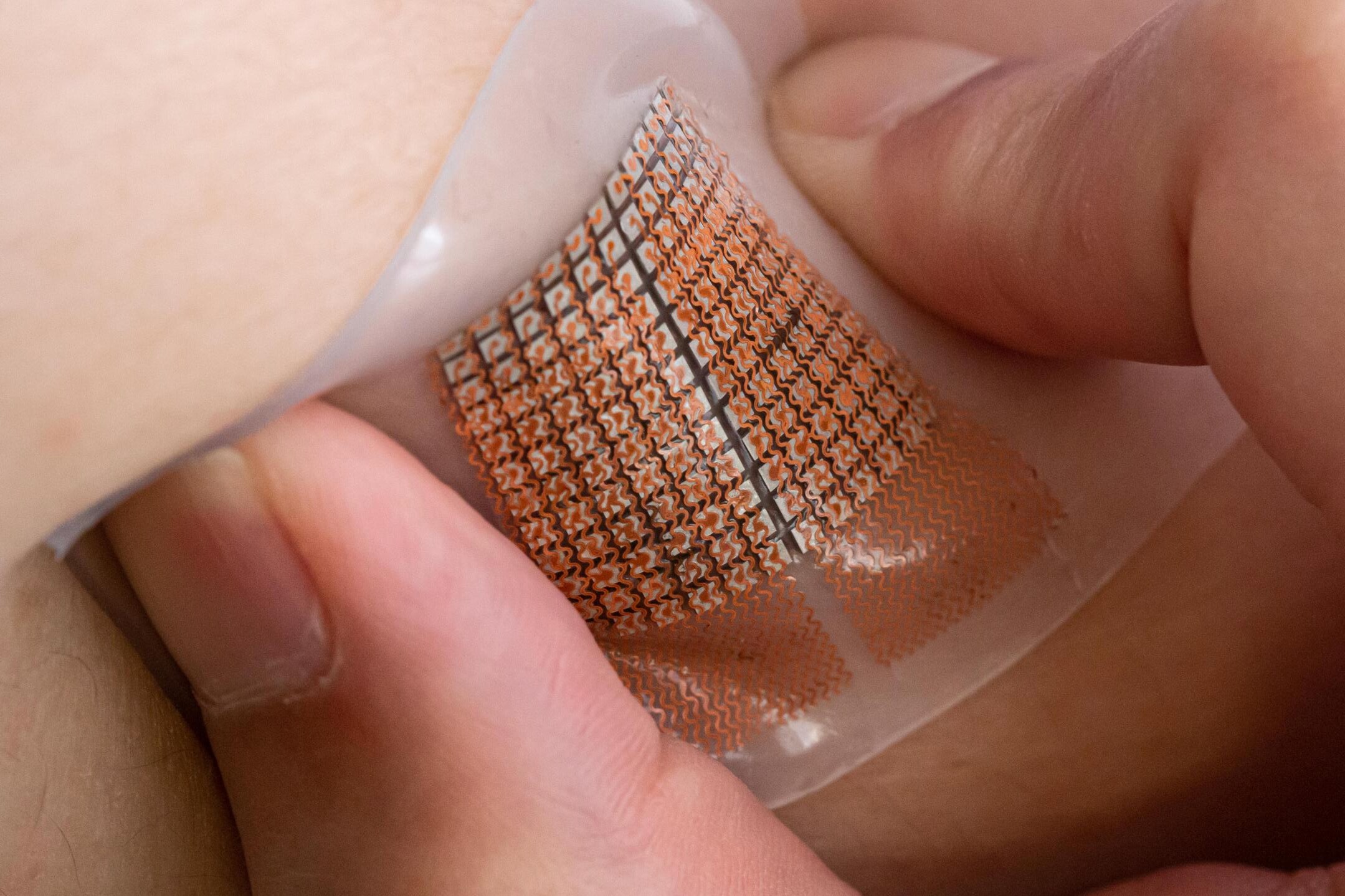 Wearable ultrasound patch could warn of cardiovascular problems