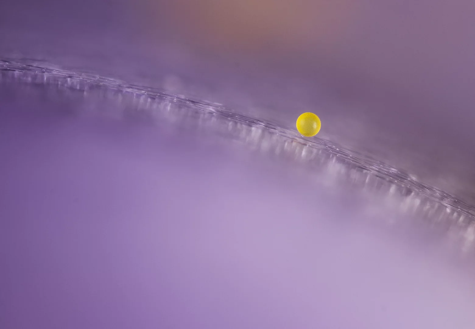 Honorable Mention. Pollen grain on a crocus flower petal. Image Stacking. 10X (Objective Lens Magnification)