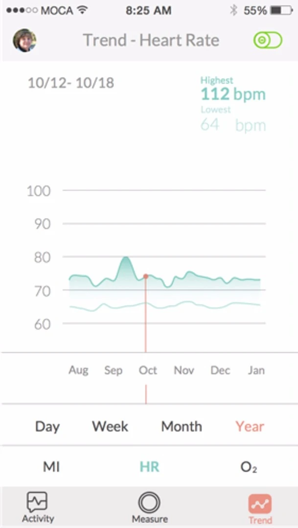 Mocaheart tracking graph