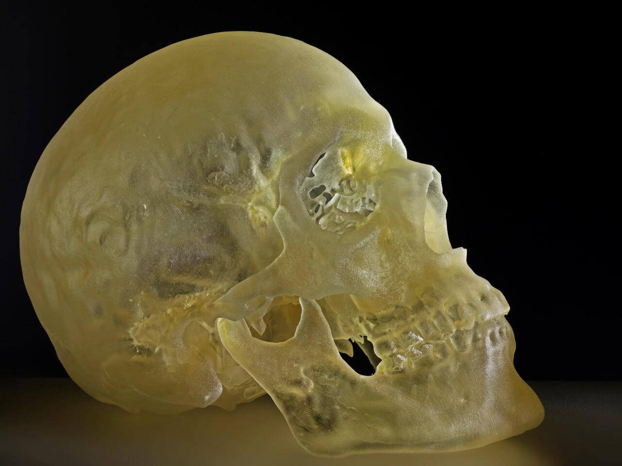 Caspar Berger's skull printed in three dimensions, in translucent resin