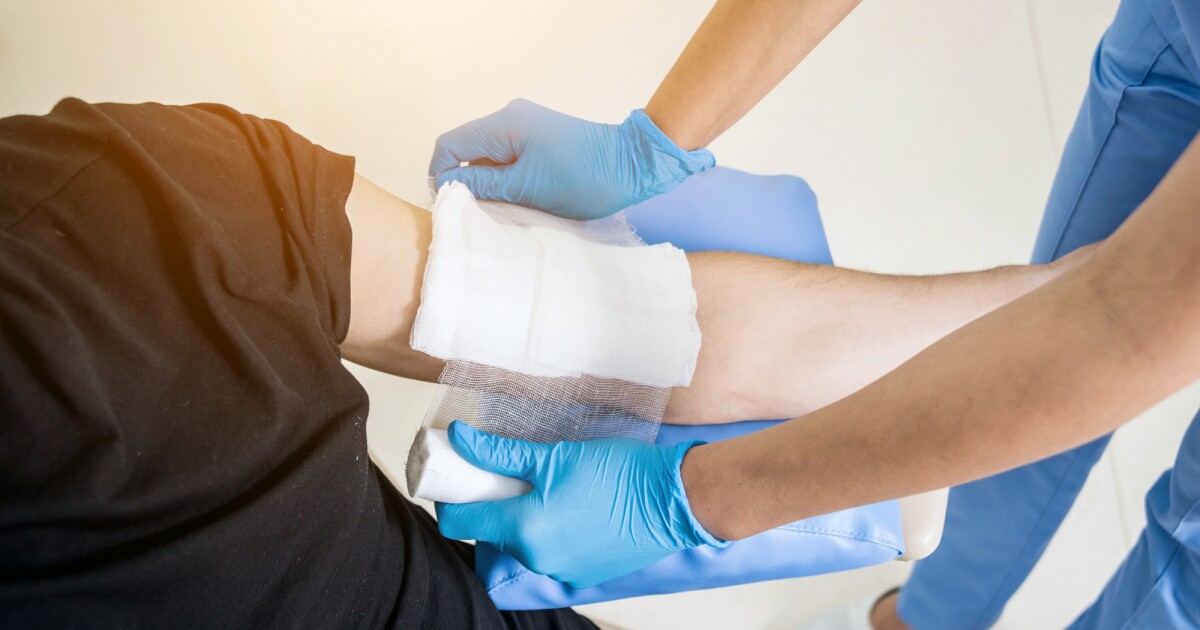 Stem cells prioritize wound healing over hair growth Stem cells prioritize wound healing over hair growth
