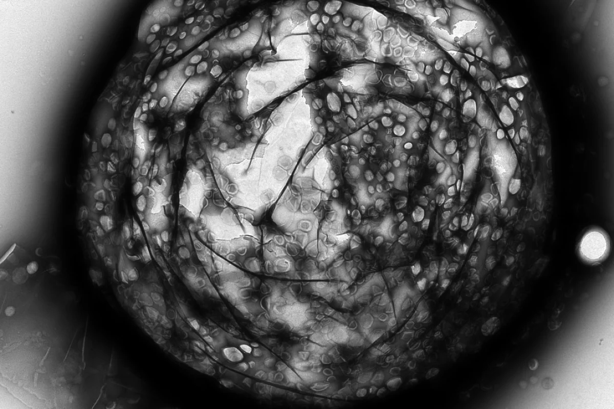 1st place in the Innovation category is an electron microscopy image of a micro bubble coated with nano-sized liposomes designed for targeted drug delivery therapeutics