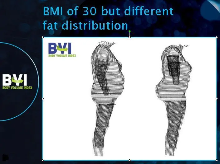 The Body Volume Index uses a 3D scanning process to analyze fat distribution