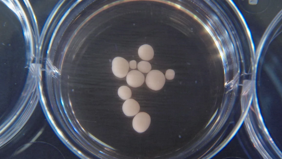 The mini-brains grown in the lab are about the size of peas