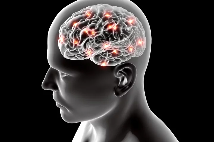 New research suggests obesity that affects the liver could play a part in the long-term onset of Alzheimer's and dementia