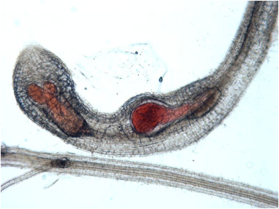 Close-up of a juvenile root-knot nematode