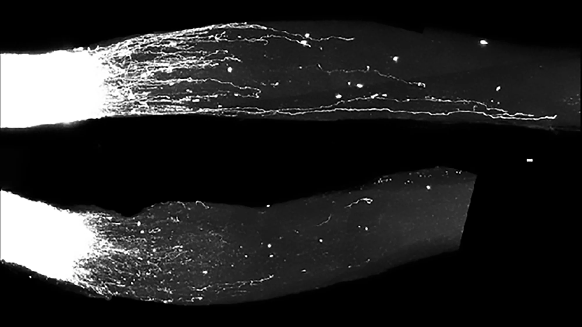 A family of RNA molecules stimulates the growth of damaged nerves, as seen in the top image