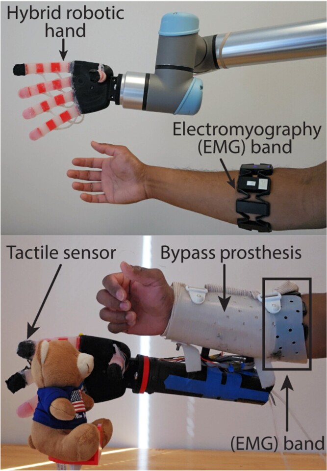 The robotic hand is controlled using EMG signals through a gesture control device (top)
